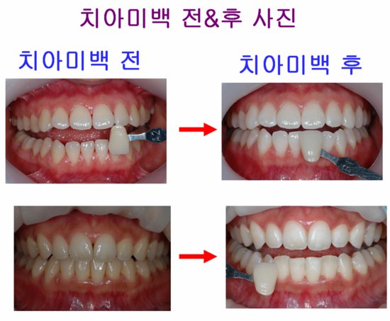 e-플랜트치과 이미지