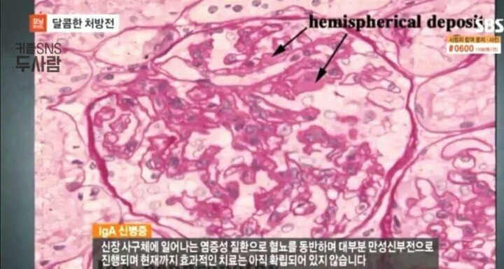 천사와 천사가 만났습니다. (대도서관x윰댕) | 인스티즈