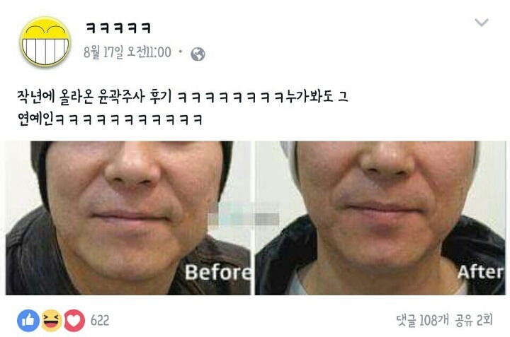하관이 연예인 하관 | 인스티즈