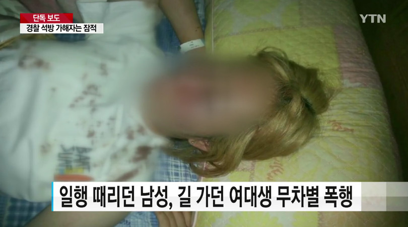 "왜 쳐다봐" 묻지 마 폭행 가해자 30분 만에 석방 | 인스티즈