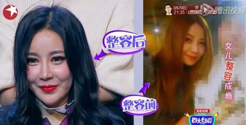 판빙빙 닮기위해 성형한 중국인들 | 인스티즈