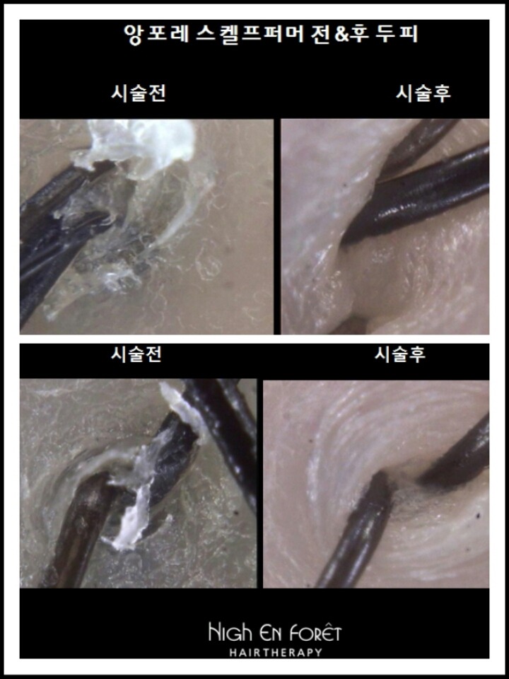 앙포레 이미지