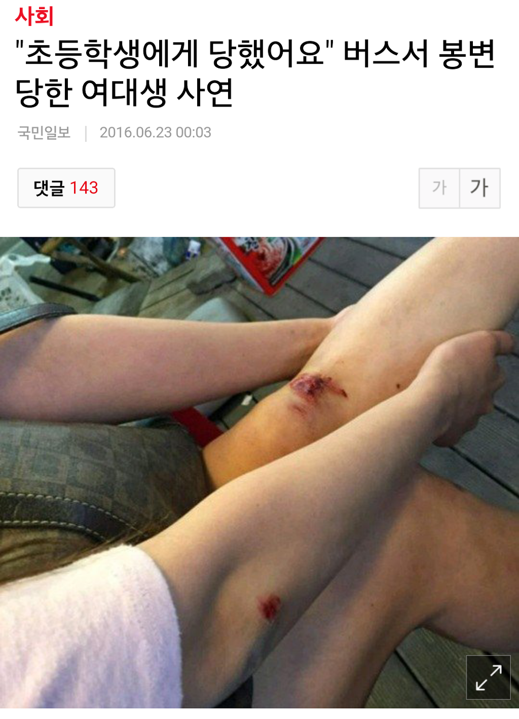 개념없는 초등학생때문에 다쳤어요 ㅠ | 인스티즈
