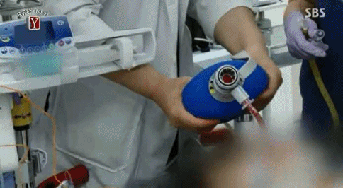 어제 시청자들 펑펑 울린 외과 의사들이 환자를 살리는 장면.gif ㄷㄷㄷ | 인스티즈