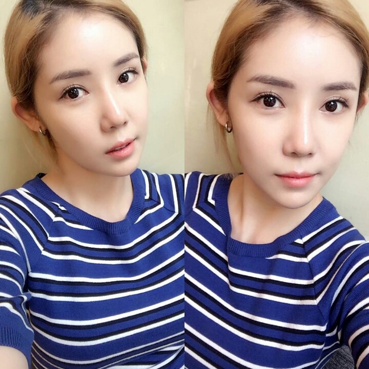 정하나 이미지