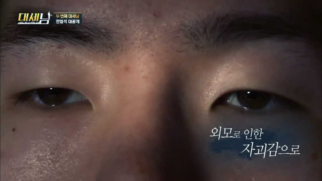 남자도 성형해야하는 EU | 인스티즈