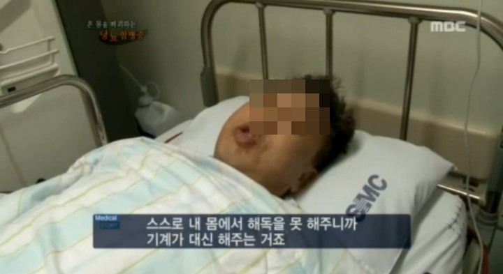 당뇨가 무서운 이유 | 인스티즈