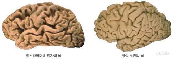 이 세상에서 둘 중 하나만 없앨수 있다면? | 인스티즈